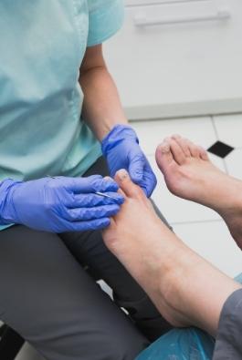 Ingrown Toe Nail foot clinic