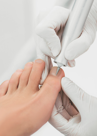 foot care